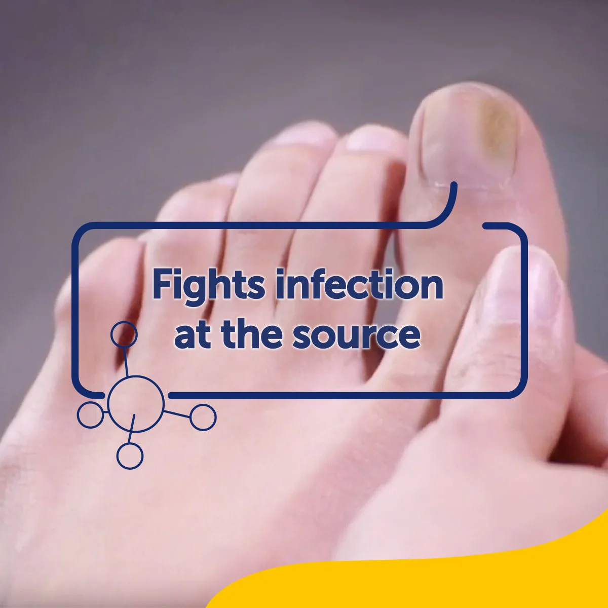 2-Pack Fungal Nail Treatment - Image 7