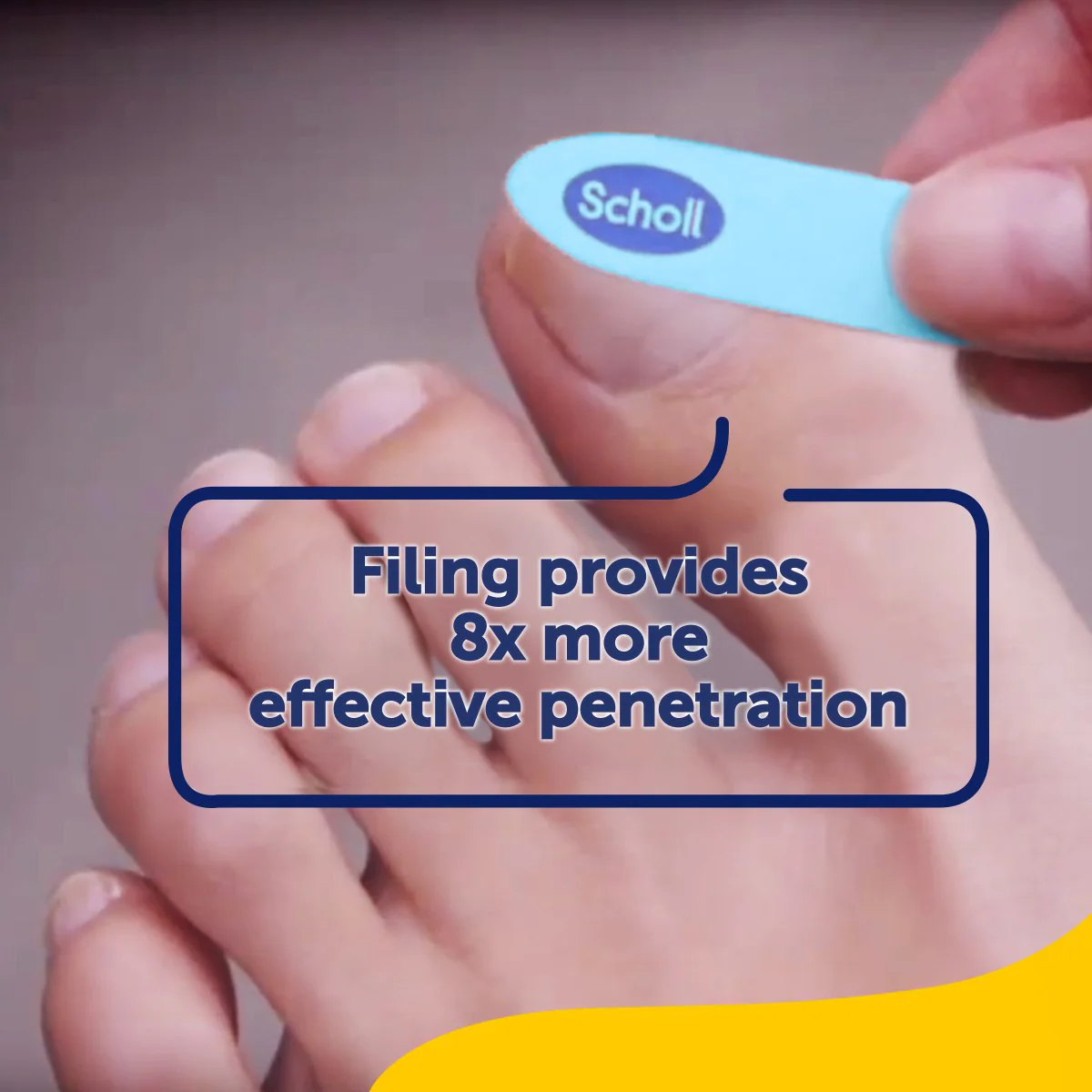 Fungal Nail Treatment Kit - Image 3